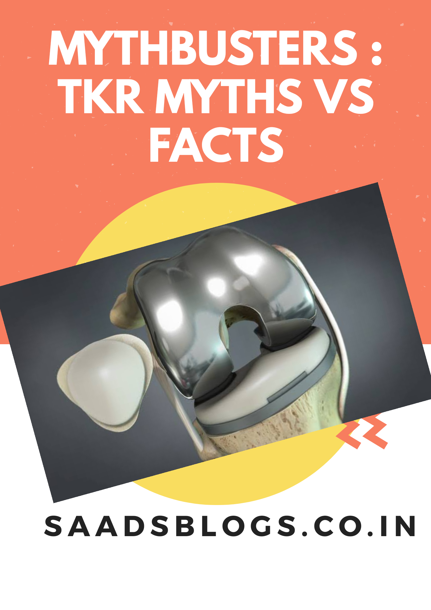 Myth busters part -2 : Total Knee Replacement Myths vs facts.